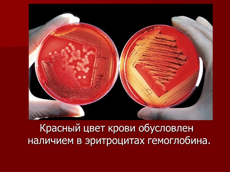 Красный цвет крови обусловлен наличием в эритроцитах гемоглобина.